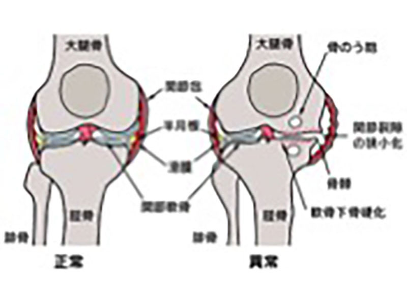 戸畑共立病院 膝専門外来